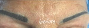 Permanent Makeup Before and After Pictures Palm Beach Gardens and Jupiter, FL
