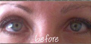 Permanent Makeup Before and After Pictures Palm Beach Gardens and Jupiter, FL